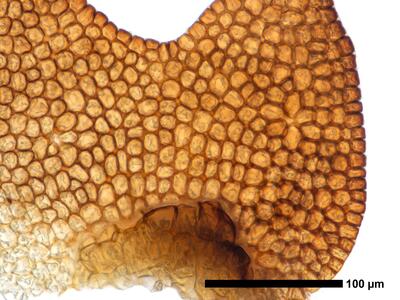 cephaloziella hampeana 1 flankenblatt zellen blattrand