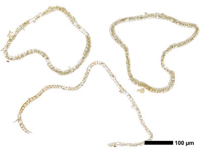 cephaloziella hampeana 1 perianth mitte quer
