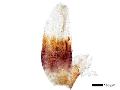 cephaloziella rubella 1 perianth