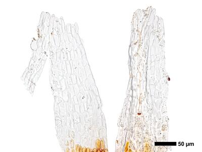 cephaloziella rubella 1 perianthmuendung
