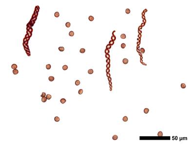 cephaloziella stellulifera 1 sporen elateren