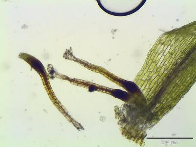 dicranella staphylina archegonien