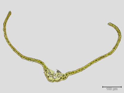 dicranum acutifolium blattquerschnitt