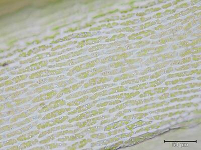 dicranum acutifolium laminazellen basis