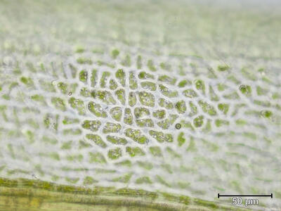 dicranum acutifolium laminazellen spitze