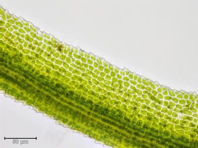 dicranum fuscescens obere laminazellen