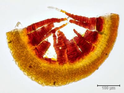 paraleucobryum sauteri peristom