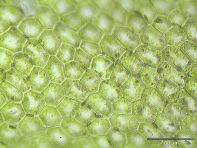 chiloscyphus pallescens zellen