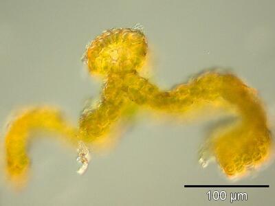 grimmia alpestris blattquerschnitt