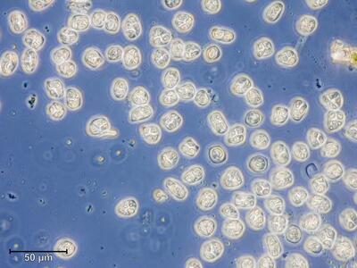 schistidium apocarpum sporen