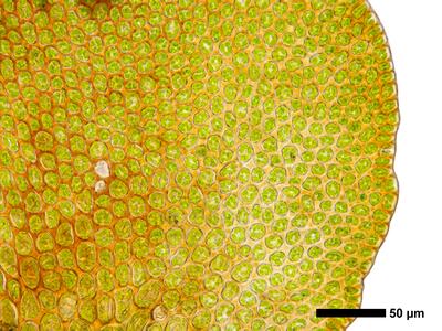 gymnomitrion alpinum 1 flankenblatt blattrand