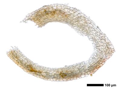 gymnomitrion brevissimum 1 perigynium mitte quer