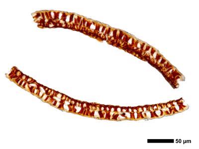 marsupella apiculata 2 kapsel quer