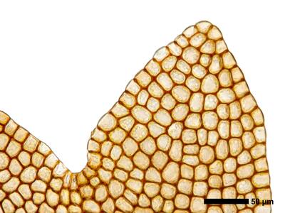 marsupella boeckii 1 flankenblatt blattspitze
