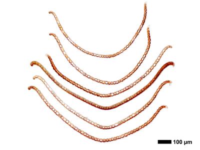 marsupella emarginata 1 flankenblatt quer