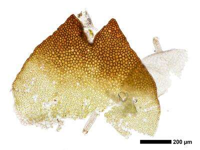 marsupella sprucei 1 female bract