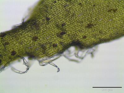 hedwigia ciliata perichaetialblatt wimpern