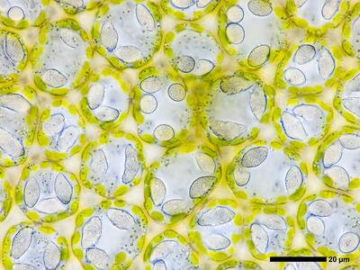 mesoptychia collaris 2 flankenblatt blattmitte detail