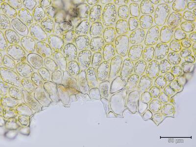 barbilophozia floerkei blattbasis