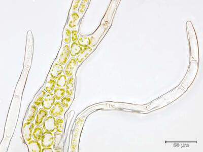 barbilophozia hatcheri cilienendzelle