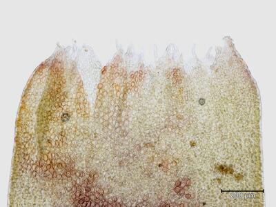 lophozia ascendens 1 perianthmuendung