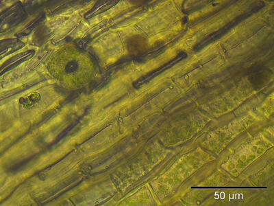 orthotrichum affine stoma