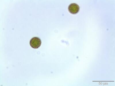 orthotrichum pulchellum sporen