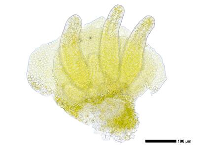 pedinophyllum interruptum 2 archegonien