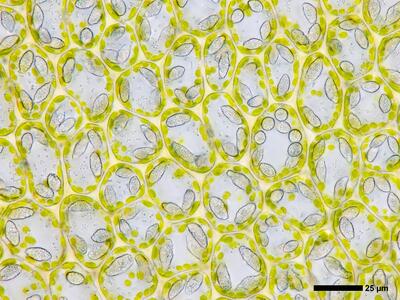 pedinophyllum interruptum 2 flankenblatt blattmitte