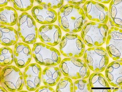 pedinophyllum interruptum 2 flankenblatt blattmitte detail