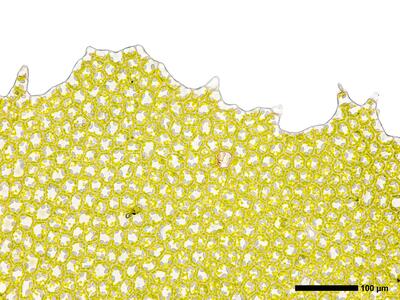 pedinophyllum interruptum 2 perianthmuendung