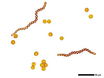 pedinophyllum interruptum 2 sporen elateren