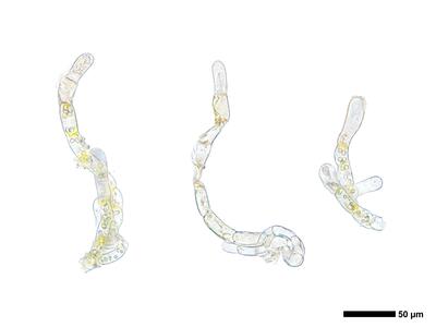 pedinophyllum interruptum 2 unterblatt