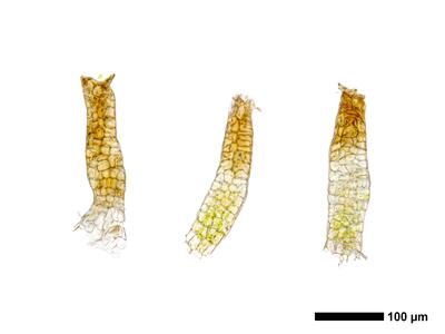 pedinophyllum interruptum frisch archegonien