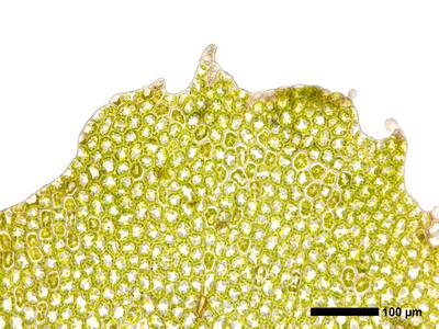 pedinophyllum interruptum frisch perichaetialblatt blattspitze