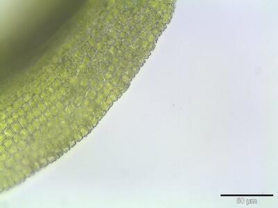 barbula convoluta papillen