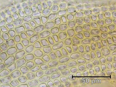 didymodon ferrugineus blattzellen