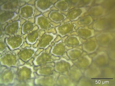 ptilidium ciliare laminazellen