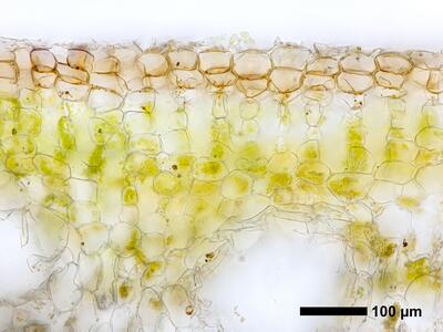 riccia bifurca swe thallus epidermis assimilation lamellae cross section