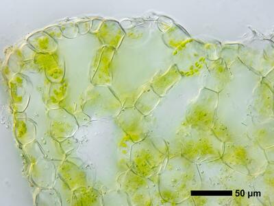 riccia canaliculata swe thallus air pore cross section