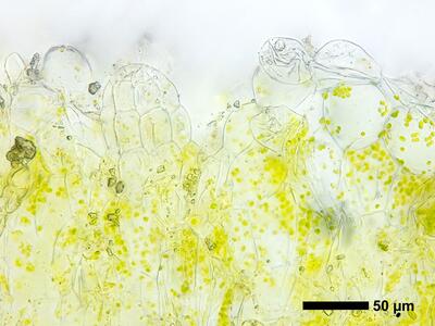 riccia cavernosa swe thallus archegonium cross section