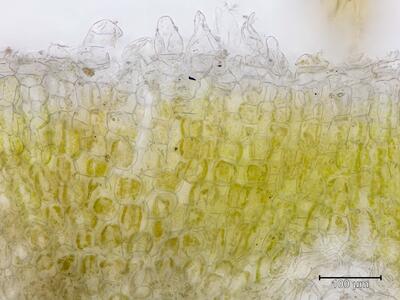riccia ciliata thallus assimilationsgewebe epithel quer