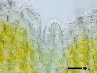 riccia ciliifera hal thallus antheridium cross section