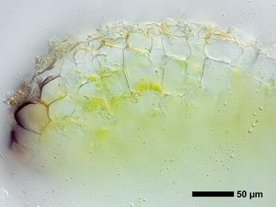 riccia gothica swe thallus epidermis cross section