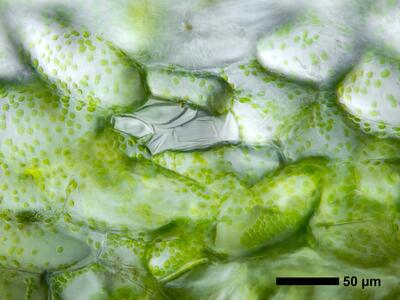 riccia huebeneriana swe thallus air pore anterior view