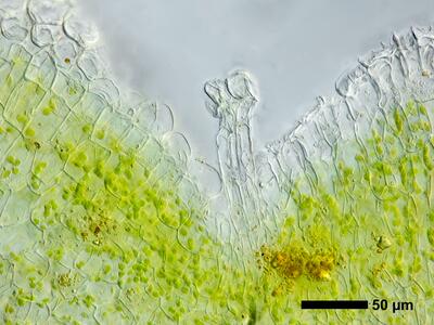 riccia sorocarpa swe archegonium neck canal cells