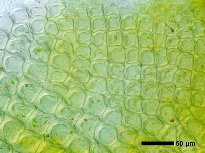 riccia sorocarpa swe thallus epidermis anterior view