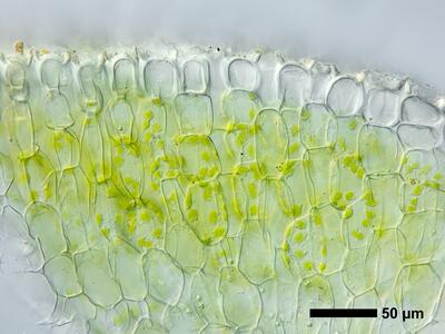 riccia sorocarpa swe thallus epidermis cross section