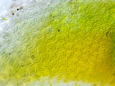 riccia sorocarpa thallus epidermis anterior view