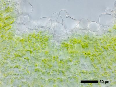 riccia subbifurca swe2 thallus epidermis cross section